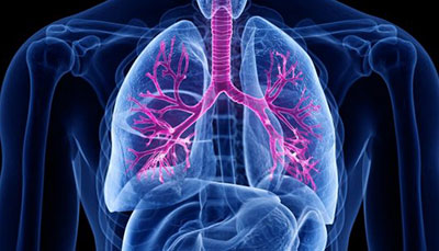 什么是慢性阻塞性肺病 (Chronic Obstructive Pulmonary Disease)，為何與新冠疫情有關(guān)？